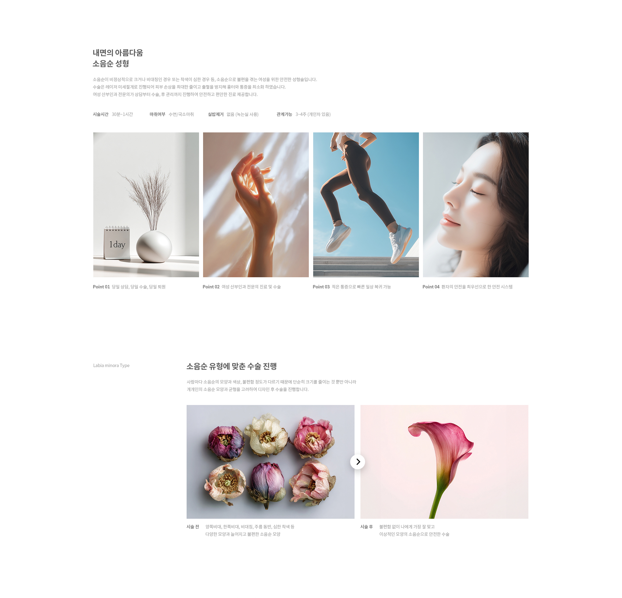 소음순 성형