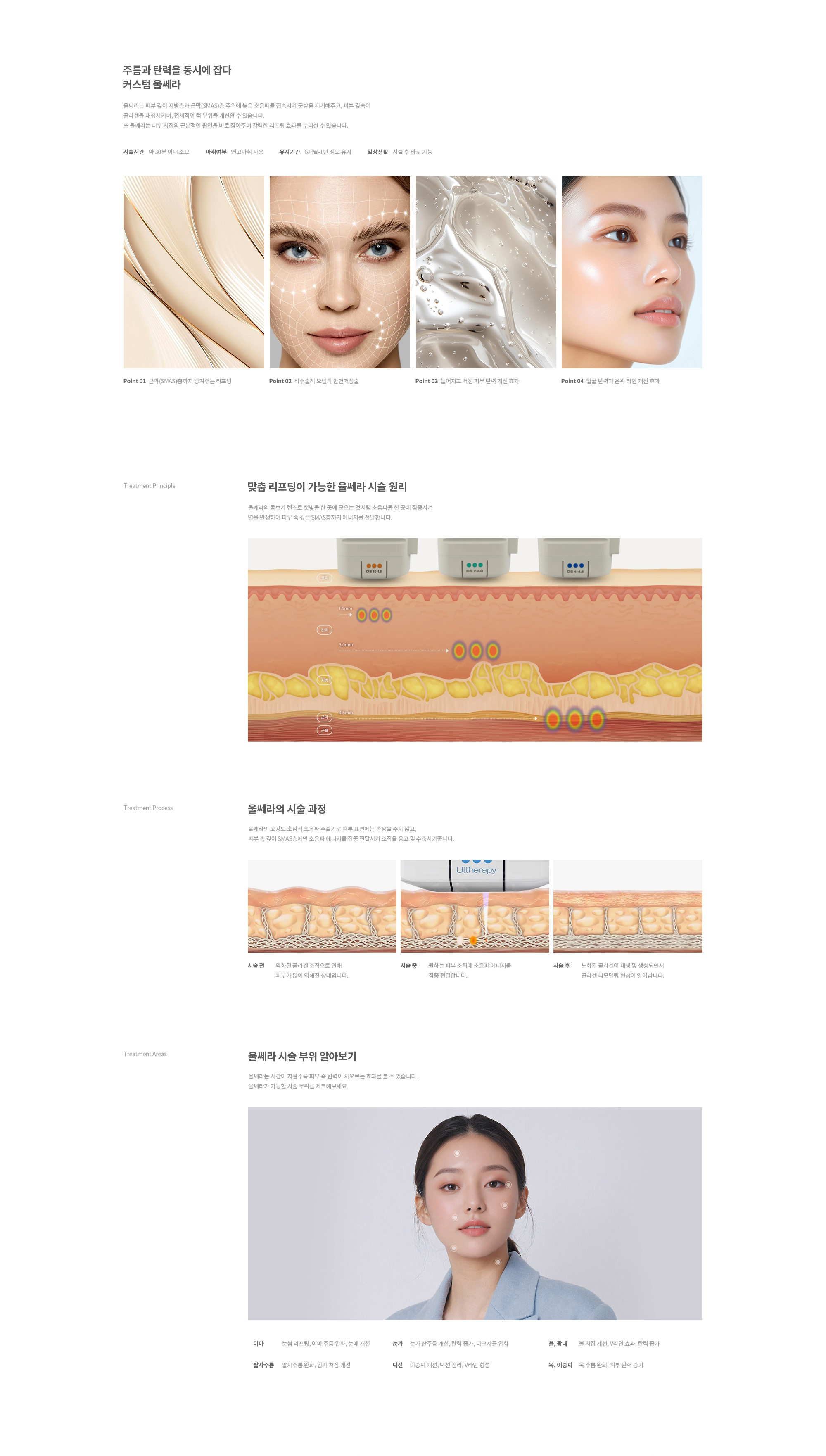 커스텀 울쎄라