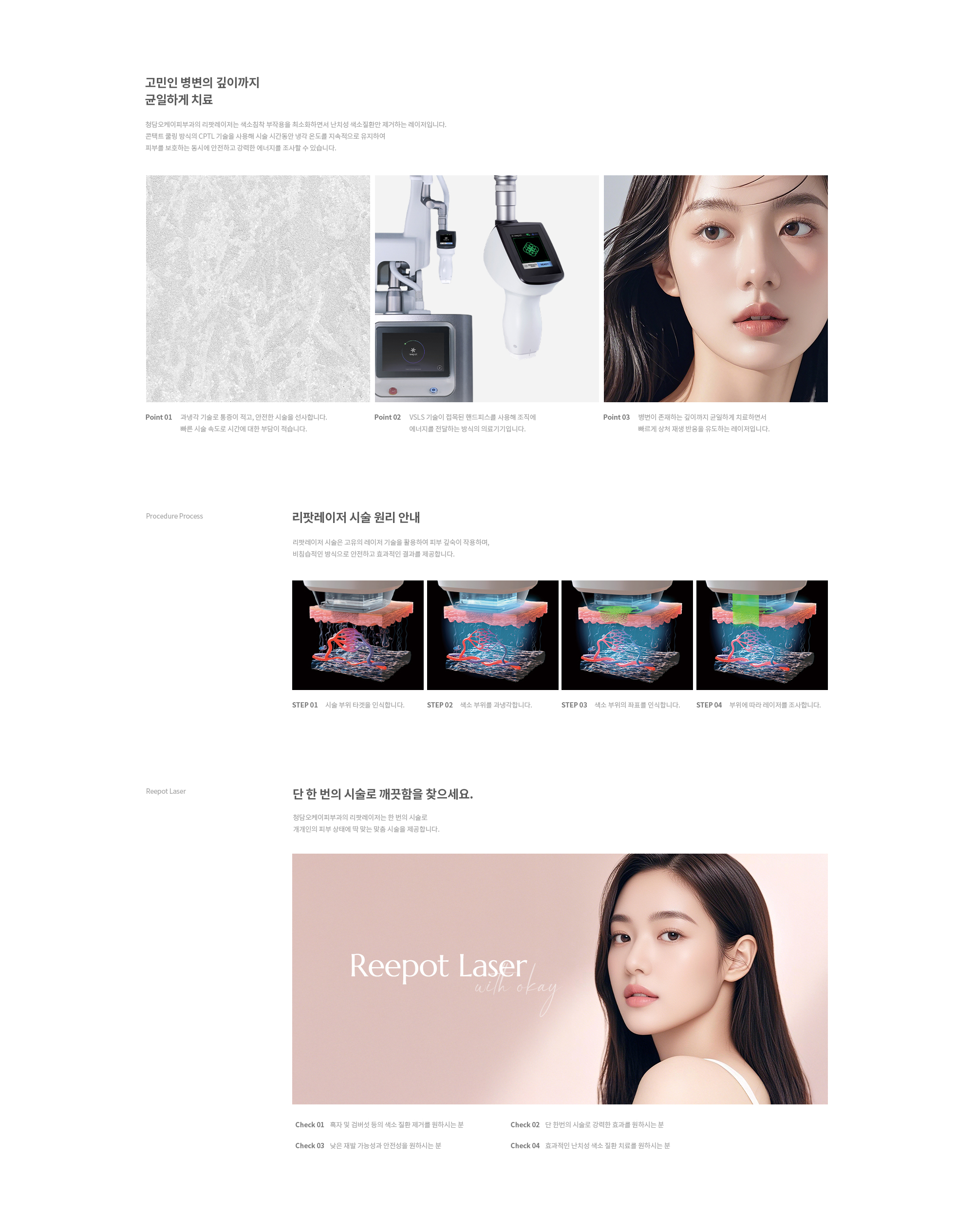 리팟레이저